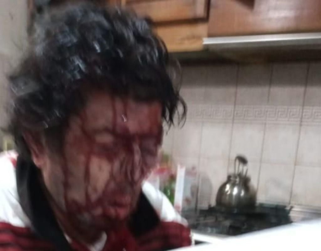 Violencia extrema en una jornada de asaltos y entraderas en la Zona Norte