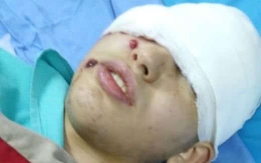 Un adolescente perdió el ojo en medio de un operativo policial 