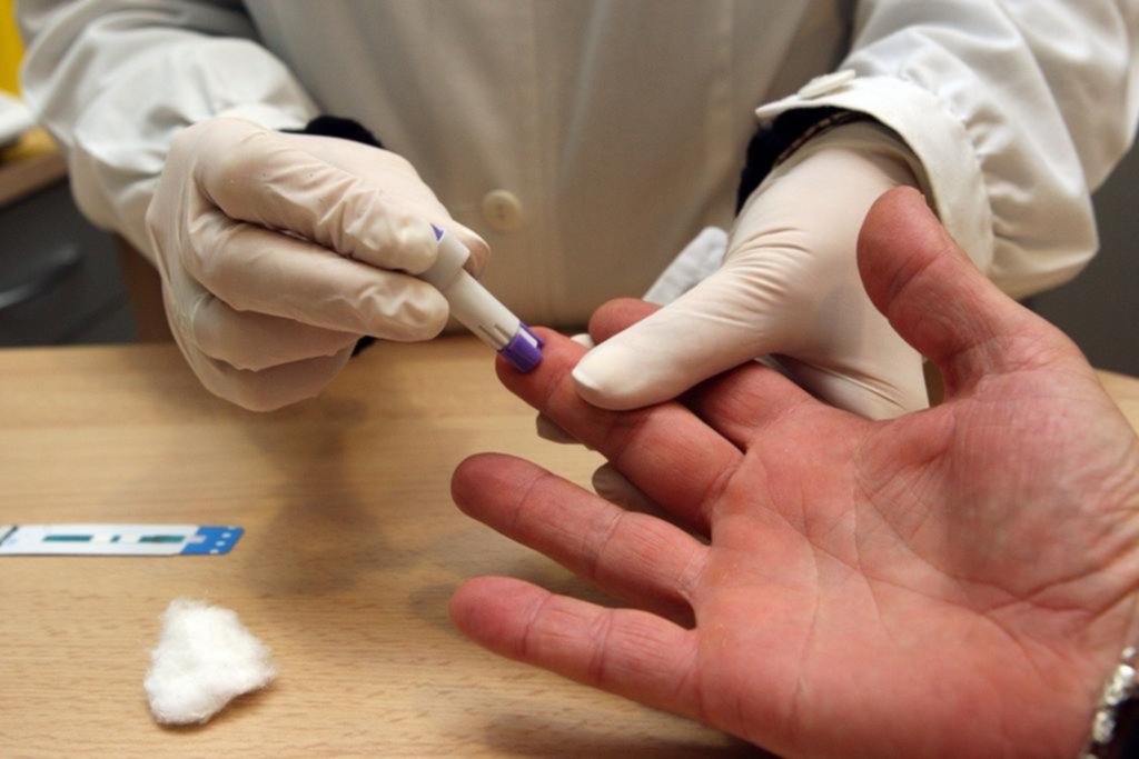 Por la pandemia de Covid, los testeos de VIH cayeron un 50 por ciento en el país