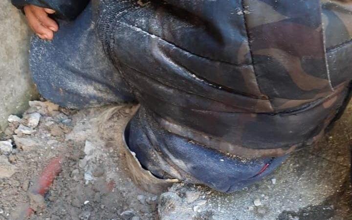 Dramático rescate de un nene, cuya pierna quedó atrapada en un desagüe