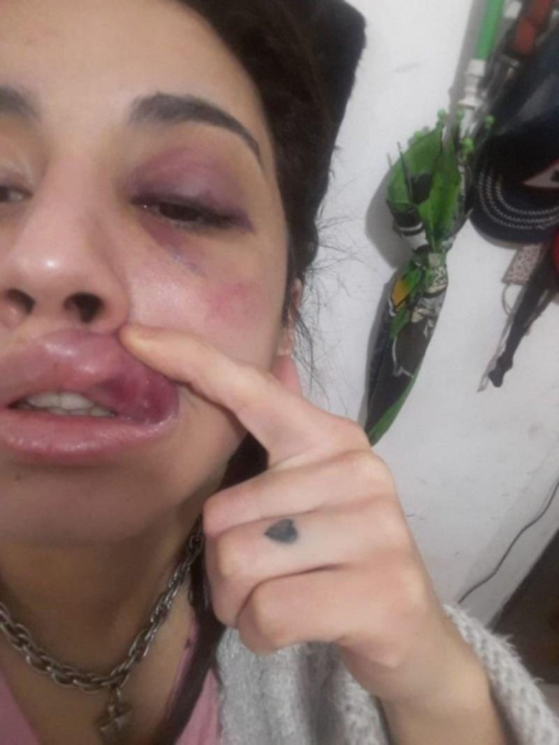 Detuvieron al hombre que desfiguró a golpes a su expareja en Berisso