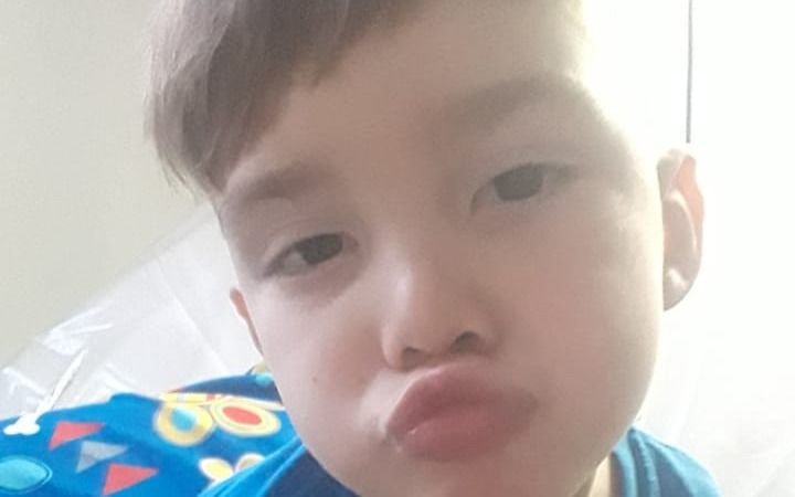 Todos por Bruno: la historia de un nene platense con un tumor en la cabeza que pide ayuda para su tratamiento