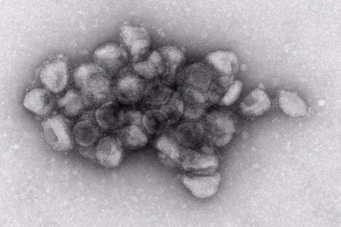 Salud: hallaron una respuesta eficaz contra el Covid y otros virus respiratorios