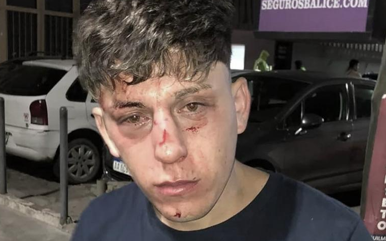 Joven agredido por patovicas en boliche de Quilmes pide Justicia