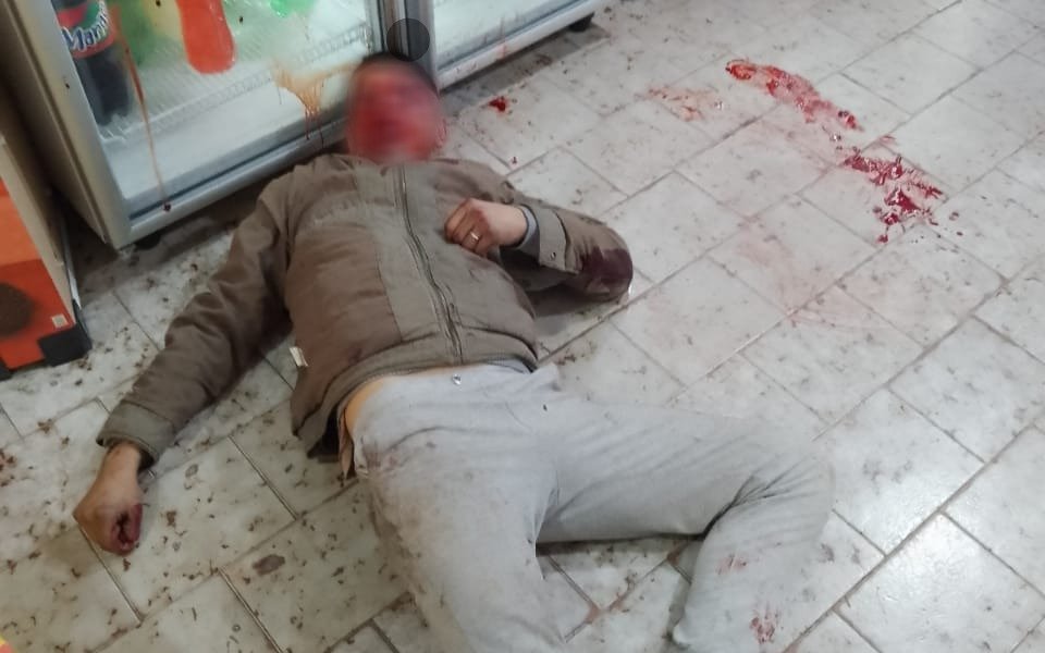 Intentó robar en un comercio de Ensenada y terminó en el hospital tras ser golpeado por un empleado