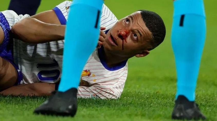 Una de cal y otra de arena: Francia venció a Austria, pero Mbappé se fracturó el tabique