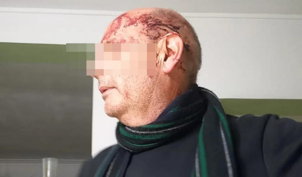 Feroz golpiza a un matrimonio durante un asalto en su domicilio de Ringuelet