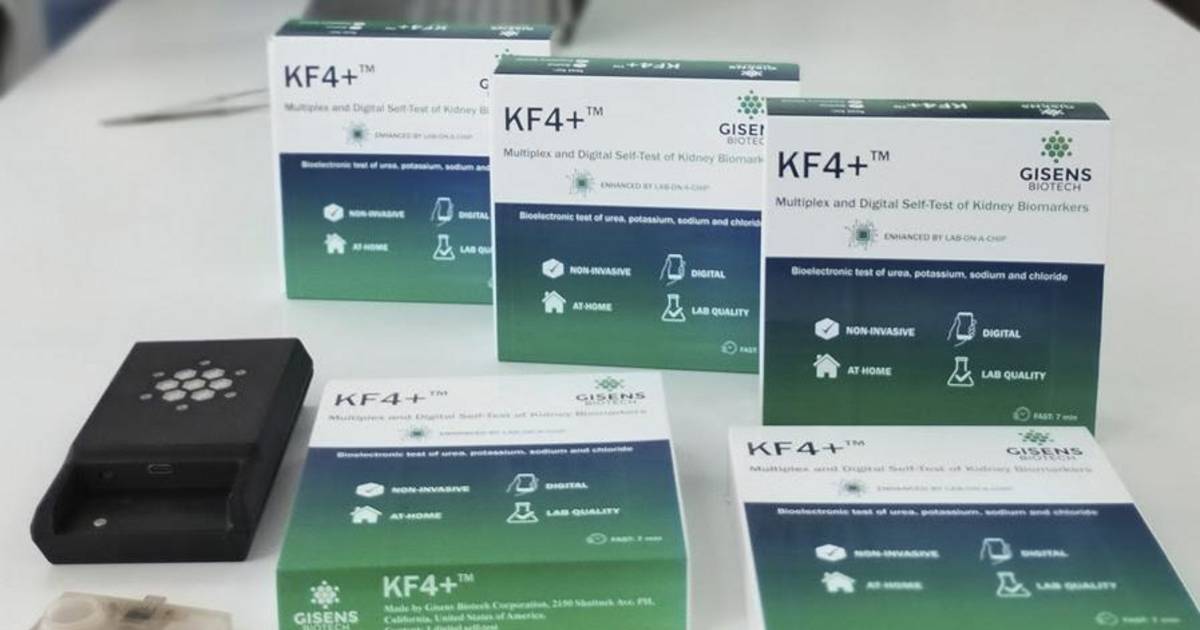 Científicos platenses avanzan con un test renal | El Dia