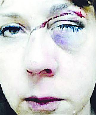 Brutal ataque a la hermana del barra prófugo