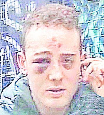 Denunció una brutal golpiza a la salida de un boliche bailable