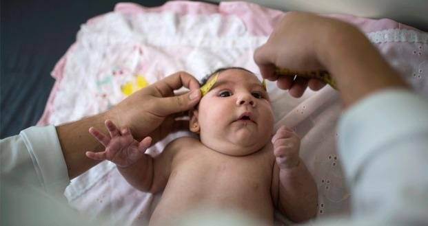 Nació un bebé de España con microcefalia provocada por el Zika