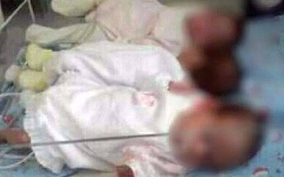 Trillizas fueron abandonadas y buscan una familia