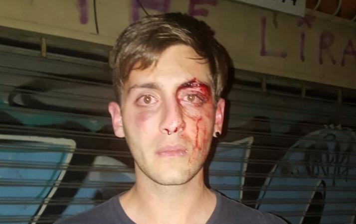 Buscan identificar a los acusados de una salvaje agresión en 4 y 49