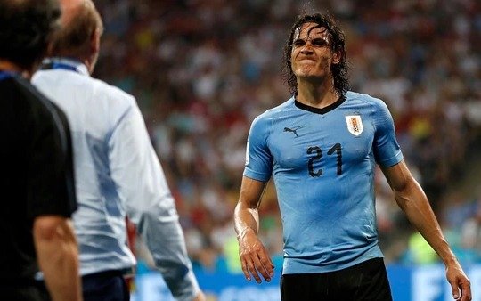 “Uruguay no es lo mismo sin Cavani”, aseguró el francés Blaise Matuidi