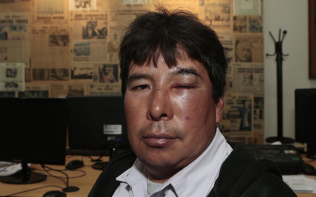Pareja de quinteros fue salvajemente atacada por una banda en El Peligro