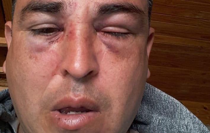 Un oficial del Servicio Penitenciario denuncia una feroz golpiza de patovicas