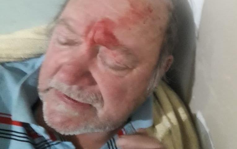 Liberaron al jubilado que mató al ladrón, pero tuvieron que internarlo