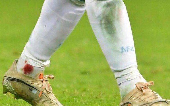 La fuerte plancha de Frank Fabra que dejó sangrando a Messi
