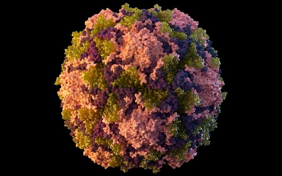 Se confirmó un caso de polio en EEUU. después de 9 años