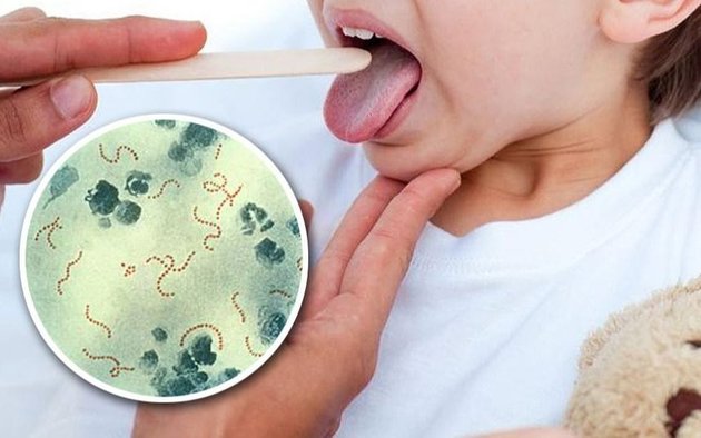 Streptococcus pyogenes: alerta del Ministerio de Salud por la bacteria que provocó 16 muertes en el país - Información General