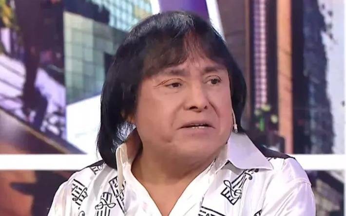 Botox y cirugías para el nuevo look de Ricky Maravilla que desató controversia en las redes