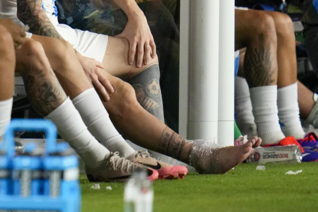 Messi tiene un esguince y se realizará estudios