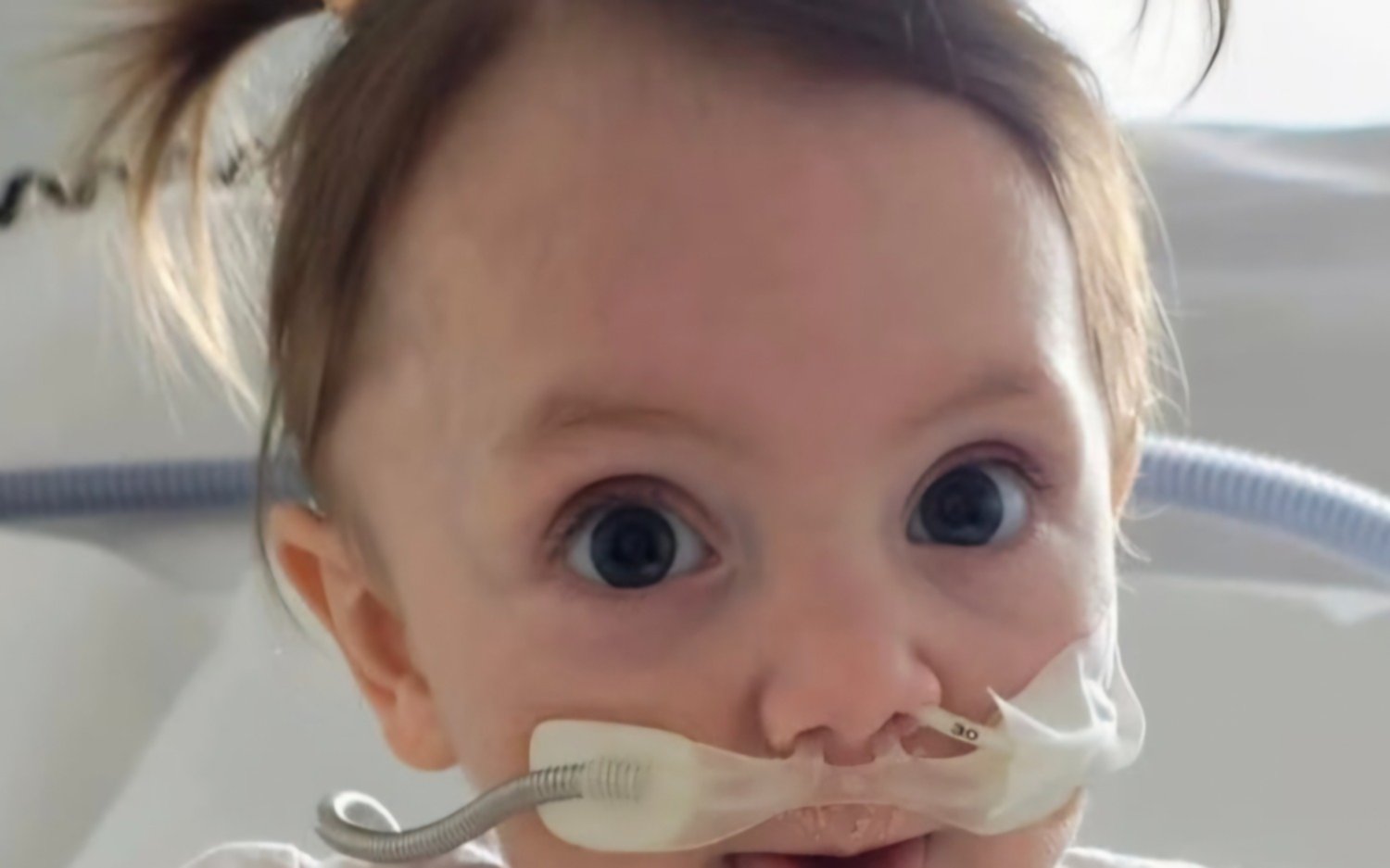 La beba tandilense Inés recibió su trasplante de corazón tras seis meses de espera