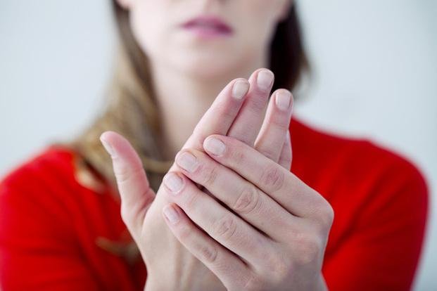 Contractura de Dupuytren