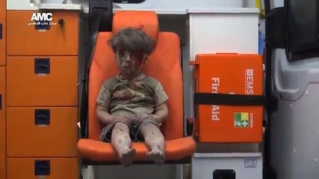La dura imagen de un nene que sobrevivió a un bombardeo en Siria conmueve al mundo