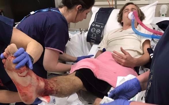 Joven australiano atacado por piojos de mar se recupera favorablemente