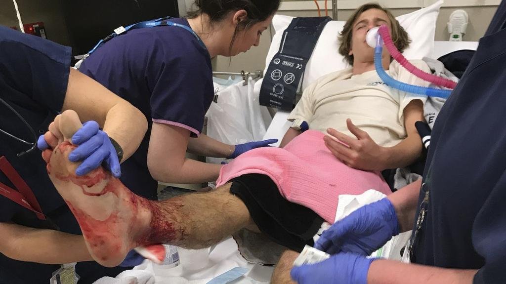Califican de “casualidad” al ataque de piojos de mar a un chico de 16 años
