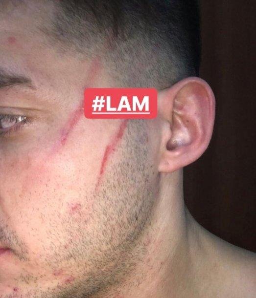 El rostro de Lhoan tras la separación