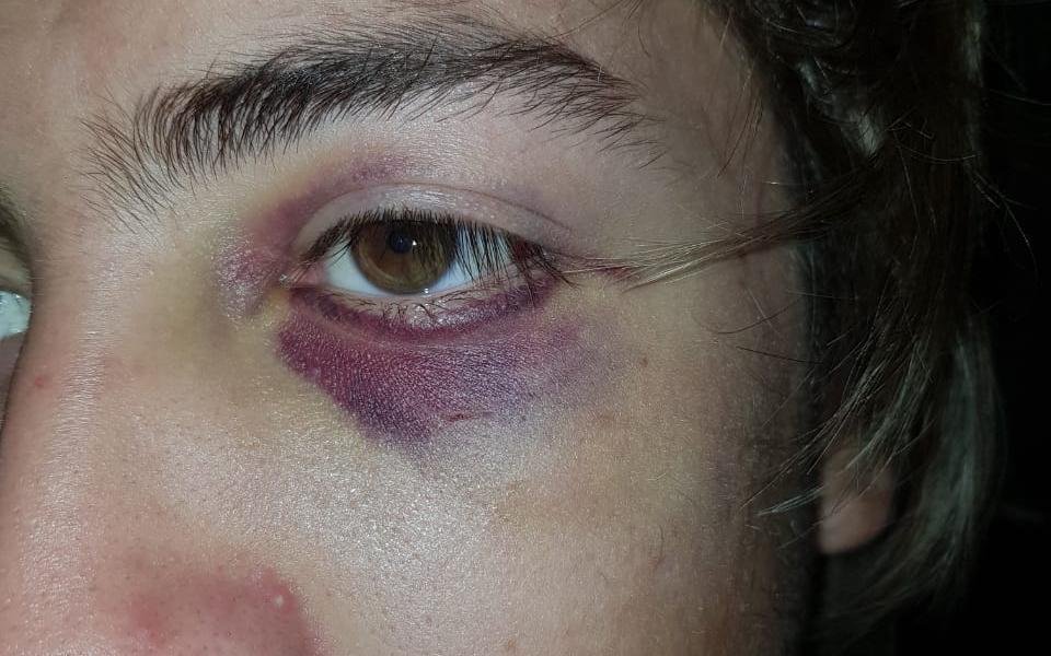 Ofrecen imágenes de cámaras para aclarar una agresión