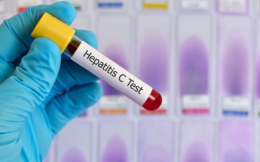 Comenzó el juicio "histórico" por contagio de VIH y hepatitis C y la muerte de "más de mil personas"