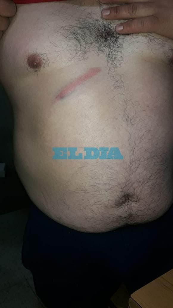 Golpes, amenazas y denuncias de aprietes en una interna entre repartidores