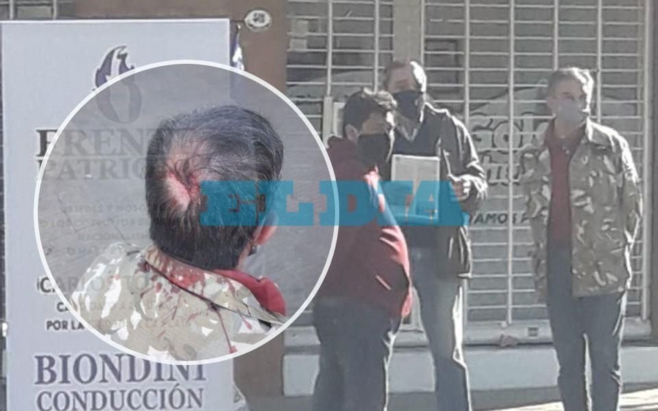 Campaña caliente en La Plata: cruces por la denuncia de ataque a precandidato a concejal