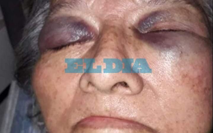 Denuncian una feroz golpiza a una abuela en un geriátrico de La Plata