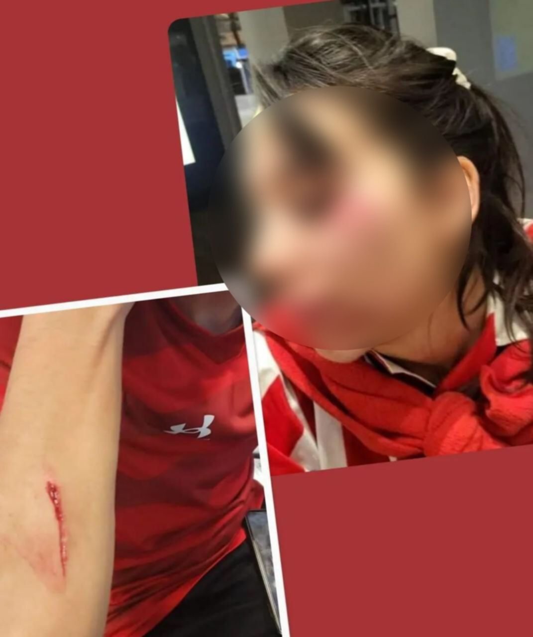 Hinchas de Estudiantes fueron agredidos en Brasil tras el partido por Copa Libertadores