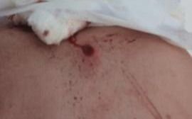 Drama en un barrio "tomado": balean a un vecino y una mujer dice que "no salgo hace 5 meses por miedo"