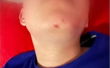Denuncian que un nene fue agredido con pelotas de golf en un reconocido country