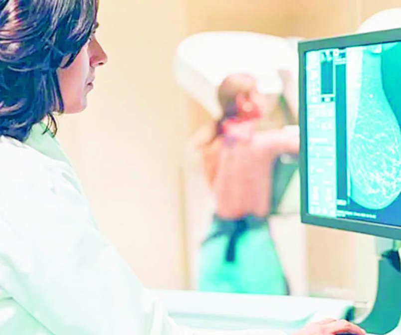 Cáncer de mama: detectan más casos entre mujeres jóvenes