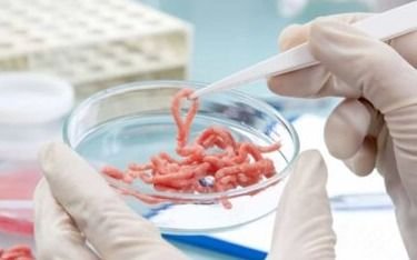Otros 4 nuevos casos de triquinosis en la Provincia y hay cerca de 100 en estudio