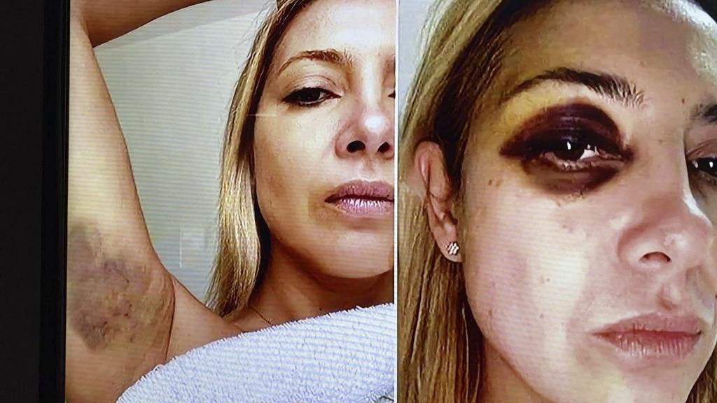 Se conocieron fotos y chats en medio de la denuncia por violencia de género contra Alberto Fernández: “Hace 3 días que me venís golpeando”