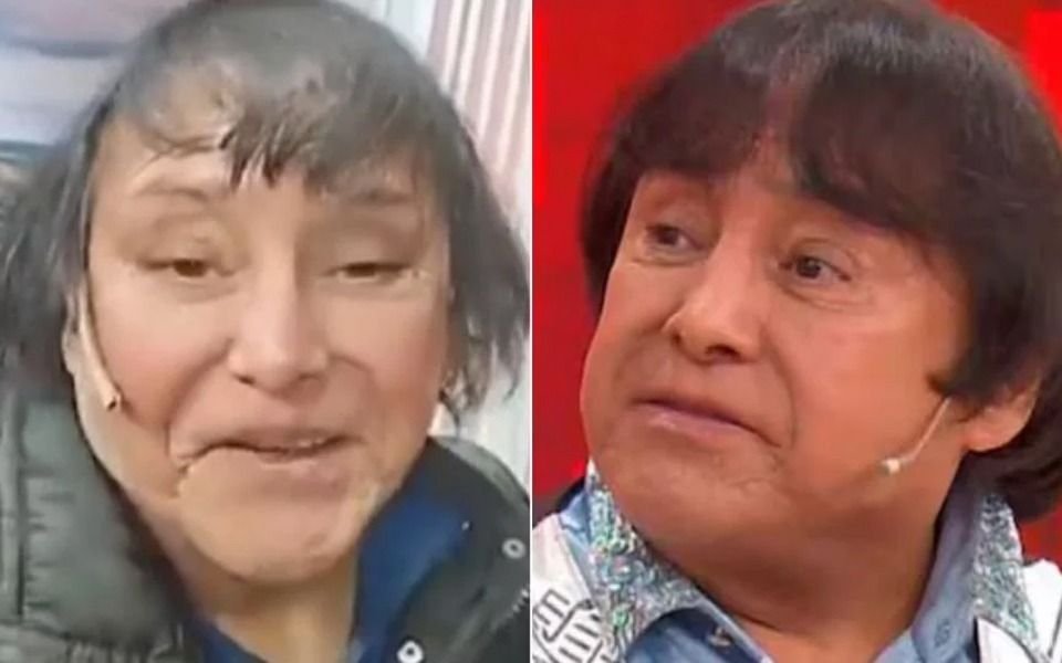 "No soy yo, será otro": Ricky Maravilla habló de los rumores de sus retoques estéticos