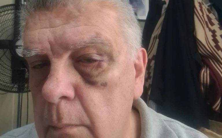 Insólita versión de los hechos del agresor de Luis Ventura en la cancha de Central Ballester