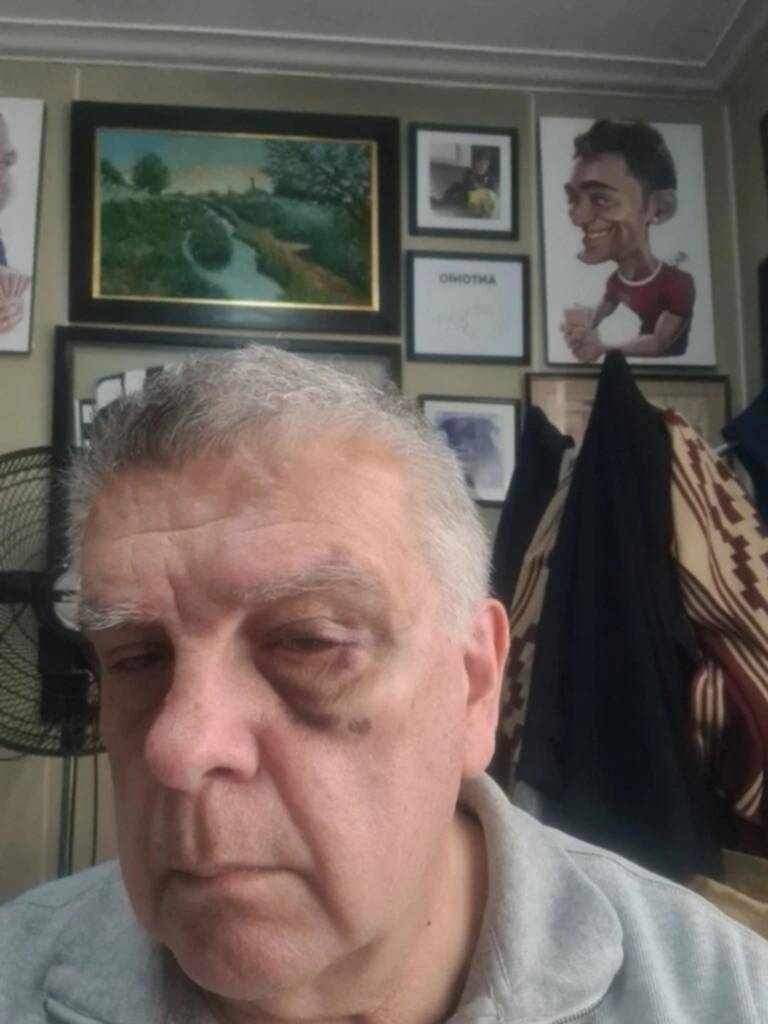 Le pidieron perdón a Ventura tras la golpiza
