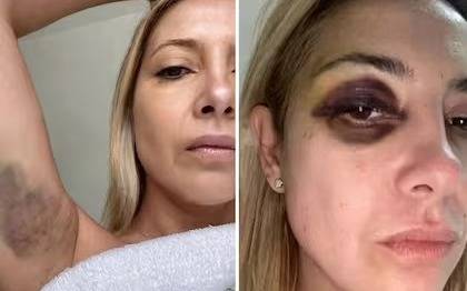 Piden que Alberto Fernández vaya a juicio por violencia de género contra Fabiola Yáñez