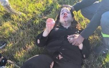 La diputada nacional libertaria Rocío Bonacci sufrió un grave accidente rumbo a Rosario
