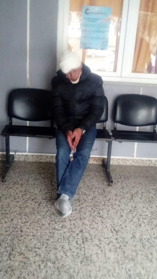 Otros dos heridos por brutales asaltos callejeros en la Región