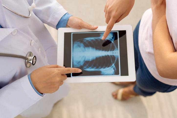 Detectan por año en el país más de 3.500 casos de fibrosis pulmonar